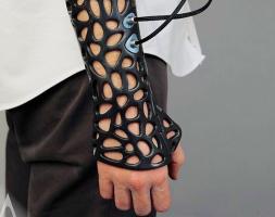3D гипс Osteoid Medical Cast